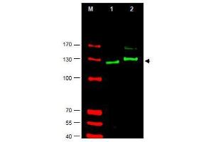 Image no. 1 for anti-GLI Family Zinc Finger 2 (GLI2) (AA 40-60), (AA 46-60), (Isoform alpha) antibody (ABIN401285) (GLI2 抗体  (Isoform alpha))