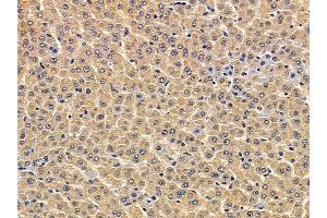 ABIN7094083 and ABIN7098127 at 1/100 staining rat liver tissue by IHC-P. (ATL3 抗体  (C-Term))