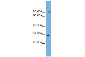 PHYH antibody used at 0. (PHYH 抗体  (N-Term))