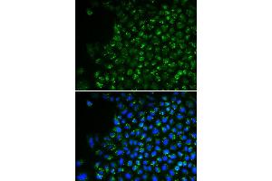 Immunofluorescence analysis of U2OS cell using PDHA1 antibody. (PDHA1 抗体)