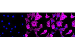 Immunocytochemical staining of C2C12 cells with Actin antibody (ABIN7797458), 1:1,000). (Recombinant Actin 抗体)