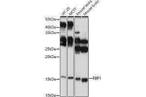 Western blot analysis of extracts of various cell lines, using RBP1 antibody (ABIN6129597, ABIN6146795, ABIN6146796 and ABIN6214136) at 1:1000 dilution. (RBP1 抗体  (AA 63-197))