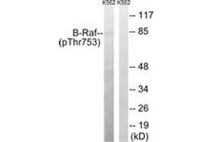 Western blot analysis of extracts from K562 cells treated with EGF 200ng/ml 30', using B-Raf (Phospho-Thr753) Antibody. (SNRPE 抗体  (pSer753))