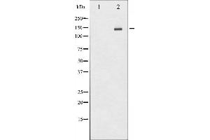 Western blot analysis of HER2 phosphorylation expression in HepG2 whole cell lysates,The lane on the left is treated with the antigen-specific peptide. (ErbB2/Her2 抗体  (pTyr1112))
