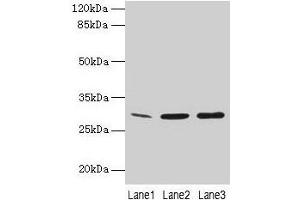 Western Blot All lanes: GTF2F2 antibody at 16 μg/mL Lane 1: Mouse spleen tissue Lane 2: K562 whole cell lysate Lane 3: A549 whole cell lysate Secondary Goat polyclonal to rabbit IgG at 1/10000 dilution Predicted band size: 29 kDa Observed band size: 29 kDa (GTF2F2 抗体  (AA 2-249))