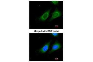 ICC/IF Image Immunofluorescence analysis of paraformaldehyde-fixed HeLa, using 15-PGDH, antibody at 1:200 dilution. (HPGD 抗体  (C-Term))