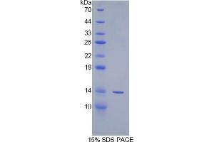 SDS-PAGE analysis of Human Spindlin 3 Protein. (SPIN3 蛋白)