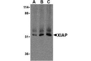 Western Blotting (WB) image for anti-X-Linked Inhibitor of Apoptosis (XIAP) (C-Term) antibody (ABIN1030806) (XIAP 抗体  (C-Term))