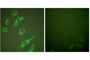 Immunofluorescence analysis of HeLa cells, treated with PMA (125ng/ml, 30mins), using 14-3-3 zeta (phospho-Ser58) antibody. (14-3-3 zeta 抗体  (pSer58))