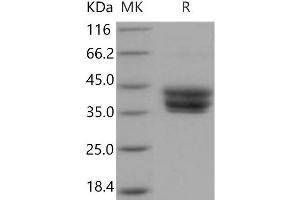 Western Blotting (WB) image for Bone Marrow Stromal Cell Antigen 1 (BST1) protein (His tag) (ABIN7320317)