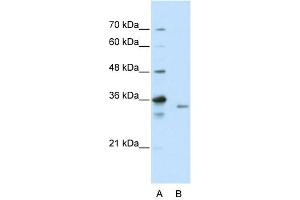 WB Suggested Anti-EXOSC3 Antibody Titration:  2. (EXOSC3 抗体  (C-Term))