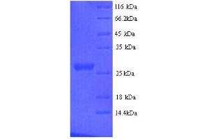 SDS-PAGE (SDS) image for Nidogen 1 (NID1) (AA 428-665) protein (His tag) (ABIN5713702)