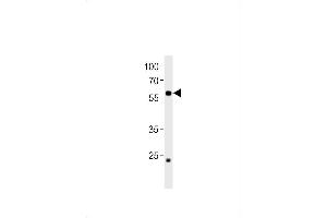 DANRE ccdc149b Antibody (N-term) Azb10009a western blot analysis in zebra fish heart tissue lysates (35 μg/lane). (CCDC149 抗体  (N-Term))