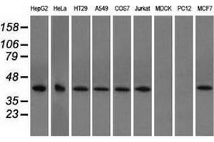 Western blot analysis of extracts (35 µg) from 9 different cell lines by using anti-ACAT2 monoclonal antibody. (ACAT2 抗体)