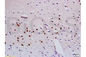 Immunohistochemistry (IHC) image for anti-Sema Domain, Immunoglobulin Domain (Ig), Short Basic Domain, Secreted, (Semaphorin) 3A (SEMA3A) (AA 22-120) antibody (ABIN737961)
