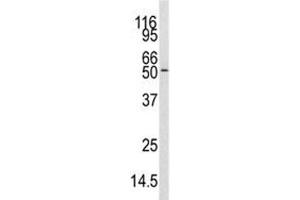 Western blot analysis of CAMKK antibody and mouse cerebellum tissue lysate. (CAMKK1 抗体  (AA 86-121))