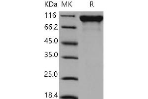 Western Blotting (WB) image for Sema Domain, Immunoglobulin Domain (Ig), Transmembrane Domain (TM) and Short Cytoplasmic Domain, (Semaphorin) 4D (SEMA4D) (Active) protein (His tag) (ABIN7320205)