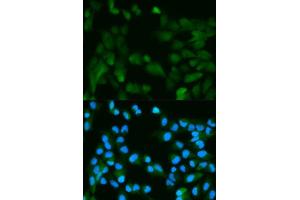 Immunofluorescence analysis of HeLa cell using PHPT1 antibody. (PHPT1 抗体  (AA 1-125))