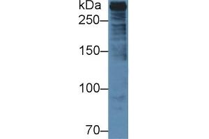 Detection of PLEC in Human U2OS cell lysate using Polyclonal Antibody to Plectin (PLEC) (PLEC 抗体  (AA 175-400))