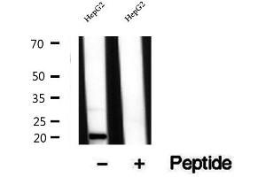 Western blot analysis of extracts of HepG2 cells, using TIM22 antibody. (TIMM22 抗体  (Internal Region))