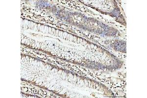 IHC analysis of DHX15/prp43 using anti-DHX15/prp43 antibody (ABIN7602738).