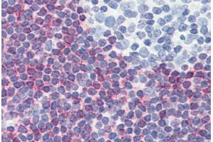 Human Tonsil (formalin-fixed, paraffin-embedded) stained with PDCD4 antibody ABIN364343 at 5 ug/ml followed by biotinylated anti-mouse IgG secondary antibody ABIN481714, alkaline phosphatase-streptavidin and chromogen. (PDCD4 抗体  (AA 1-469))