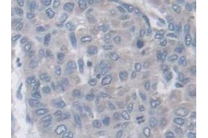 Immunohistochemistry (IHC) image for anti-Actin Related Protein 2/3 Complex, Subunit 2, 34kDa (ARPC2) (AA 1-300) antibody (ABIN7441580)