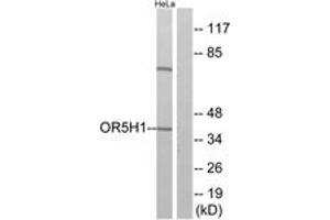 Western Blotting (WB) image for anti-Olfactory Receptor, Family 5, Subfamily H, Member 1 (OR5H1) (AA 262-311) antibody (ABIN2891026) (OR5H1 抗体  (AA 262-311))