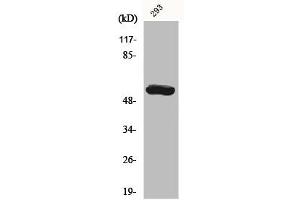 Western Blot analysis of 293 cells using CYP19A1 Polyclonal Antibody (Aromatase 抗体  (Internal Region))