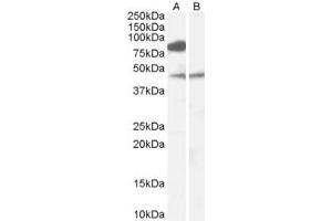 Western Blotting (WB) image for anti-Chromosome 19 Open Reading Frame 55 (C19orf55) (N-Term) antibody (ABIN2784664) (C19orf55 抗体  (N-Term))