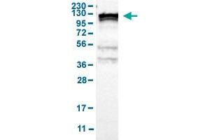 Western Blot analysis of human cell line RT-4 with KIF11 polyclonal antibody . (KIF11 抗体  (AA 373-477))