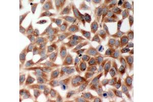 Immunohistochemistry (IHC) image for anti-TNF Receptor-Associated Factor 2 (TRAF2) (AA 305-325), (Middle Region) antibody (ABIN3044047)