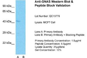 Host: Rabbit  Target Name: GNAS  Sample Tissue: MCF7 Whole Cell  Lane A:  Primary Antibody Lane B:  Primary Antibody + Blocking Peptide Primary Antibody Concentration: 1 µg/mL Peptide Concentration: 5 µg/mL Lysate Quantity: 41 µg/laneGel Concentration:. (GNAS 抗体  (N-Term))