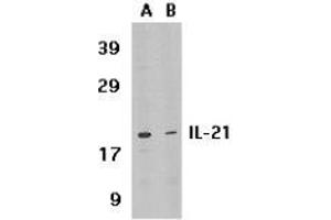 Western blot analysis of IL-21 expression in HL-60 cell lysate in the absence (lane A) or presence of blocking peptide (lane B) with AP30413PU-N IL-21 antibody at 1 μg /ml. (IL-21 抗体  (Intermediate Domain))