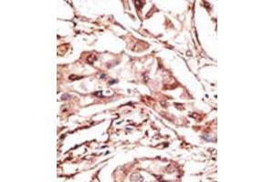 Image no. 2 for anti-Dickkopf Homolog 4 (Xenopus Laevis) (DKK4) (AA 7-36), (N-Term) antibody (ABIN357073) (DKK4 抗体  (N-Term))