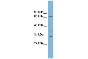 WB Suggested Anti-TBCCD1 Antibody Titration: 0.