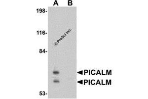 Western Blotting (WB) image for anti-Phosphatidylinositol Binding clathrin Assembly Protein (PICALM) (N-Term) antibody (ABIN1031513)
