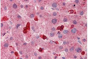 Immunohistochemistry (Formalin-fixed Paraffin-embedded Sections) (IHC (fp)) image for anti-Solute Carrier Family 8 (Sodium/calcium Exchanger), Member 3 (SLC8A3) (AA 144-193) antibody (ABIN768913)