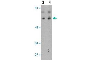 Western blot analysis of BCL2L13 in K-562 cell lysate with BCL2L13 polyclonal antibody  at 2 and 4 ug/mL . (BCL2L13 抗体  (Internal Region))