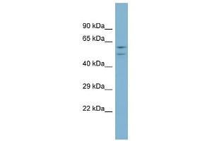 ATP6V1B1 antibody used at 1 ug/ml to detect target protein.