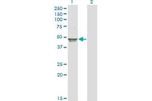 Western Blotting (WB) image for anti-Acetyl-CoA Acyltransferase 1 (ACAA1) (AA 217-315) antibody (ABIN513047)