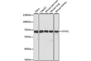 Western blot analysis of extracts of various cell lines using SYVN1 Polyclonal Antibody at dilution of 1:1000. (SYVN1 抗体)