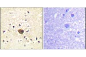 Immunohistochemistry (IHC) image for anti-Ras Protein-Specific Guanine Nucleotide-Releasing Factor 1 (RASGRF1) (AA 882-931) antibody (ABIN2888750) (RASGRF1 抗体  (AA 882-931))