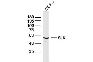 MCF-7 lysates probed with SLK Polyclonal Antibody, Unconjugated  at 1:300 dilution and 4˚C overnight incubation. (SLK 抗体  (AA 165-270))