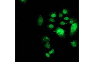 Anti-CDK2 mouse monoclonal antibody (ABIN2454523) immunofluorescent staining of COS7 cells transiently transfected by pCMV6-ENTRY CDK2 (RC200494). (CDK2 抗体)