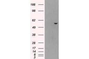 Western Blotting (WB) image for anti-ATP Synthase, H+ Transporting, Mitochondrial F1 Complex, beta Polypeptide (ATP5B) antibody (ABIN2716441)