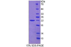 SDS-PAGE analysis of Human vWFCP Protein. (ADAMTS13 蛋白)