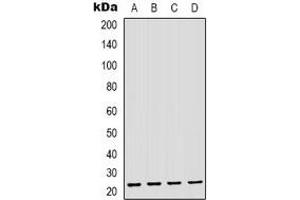 Western blot analysis of GAS3 expression in THP1 (A), MDAMB435 (B), mouse brain (C), mouse liver (D) whole cell lysates. (PMP22 抗体  (C-Term))