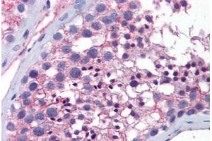 Human Testis: Formalin-Fixed, Paraffin-Embedded (FFPE)