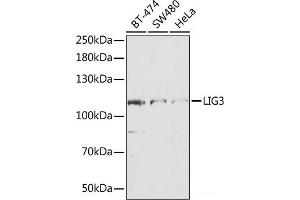 Western blot analysis of extracts of various cell lines using LIG3 Polyclonal Antibody at dilution of 1:1000. (LIG3 抗体)